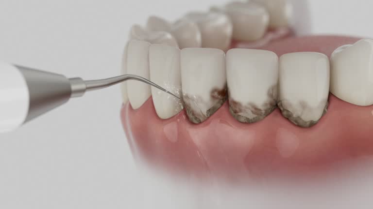 Reliable Dental contractor in Flagtown, NJ by Smile Center Dentistry